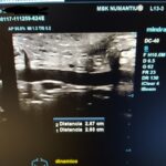 Diástasis Abdominal Perinium Entrenamiento Online