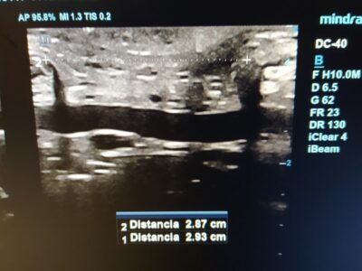 Diástasis Abdominal Perinium Entrenamiento Online