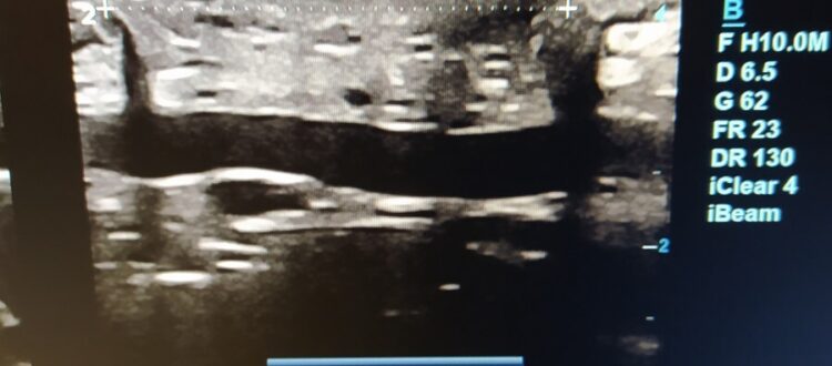 Diástasis Abdominal Perinium Entrenamiento Online